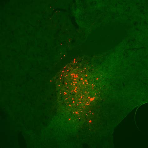 Addgene Aav Data Hub Paav Hsyn Dio Mcherry In Rat Aav