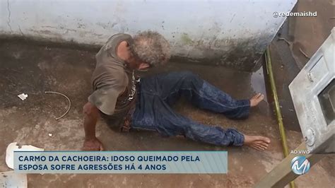 Idoso queimado pela esposa sofre agressões há anos Rede Mais