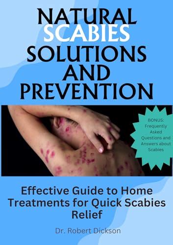 Natural Scabies Solutions And Prevention Effective Guide To Home