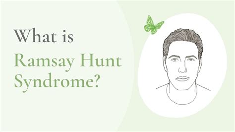 What Is Ramsay Hunt Syndrome YouTube