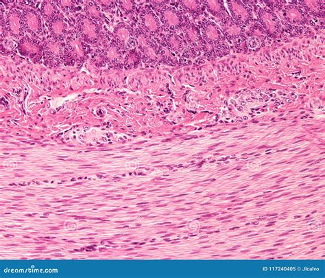 Small Intestine. Meissner Plexus Stock Image - Image of tract, hematoxylin: 117240405