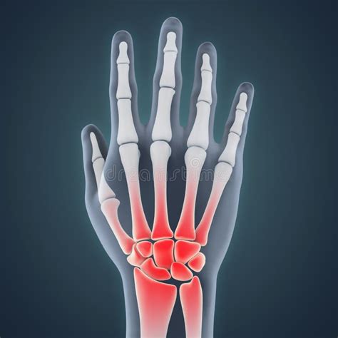 Human Hand Anatomy Illustration Stock Illustration - Illustration of phalanges, anatomic: 126146347