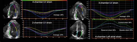 Hemodynamics Contribute To La Strain Exercise Tolerance And Events In