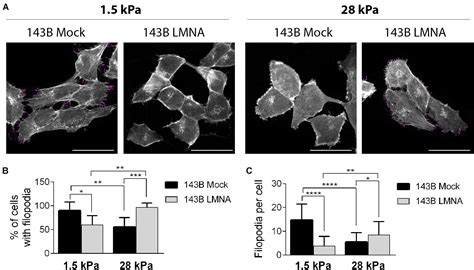 Frontiers Lamin A C Mechanosensor Drives Tumor Cell Aggressiveness