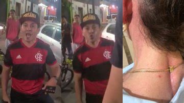 Policial Civil Filmado Agredindo Advogada Afastado Das Fun Es