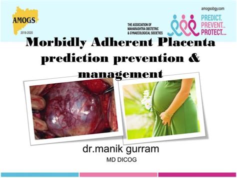 Morbidly Adherent Placenta Prediction Prevention And Management Ppt