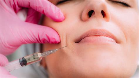 Dermal Fillers Aesthetic Nurse At Maple House