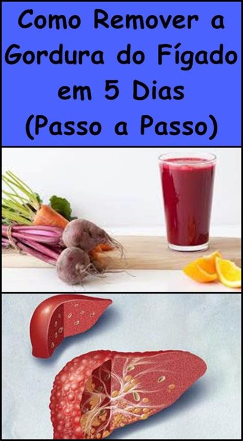 Como Remover A Gordura Do F Gado Em Dias Passo A Passo Receitas