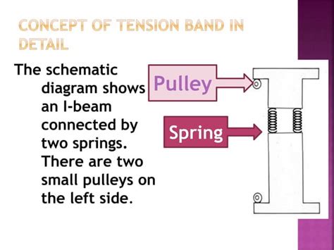 Principle of tension band wiring n its application