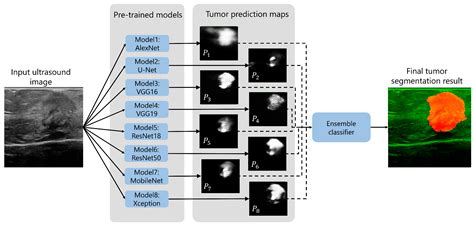 Cancers Free Full Text Toward Intraoperative Margin Assessment