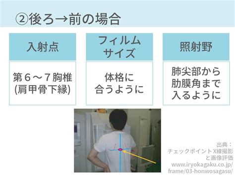 胸部レントゲン、撮影方法