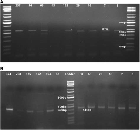 Ethidium Bromide Stained Agarose Gel Electrophoresis Of The PCR Product