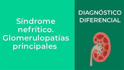 Diagn Stico Diferencial S Ndrome Nefr Tico Glomerulopat As Principales