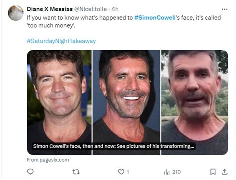 Simon Cowells ‘shocking Face Transformation Sparks Concerns