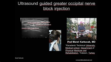 Occipital Nerve Block Injection