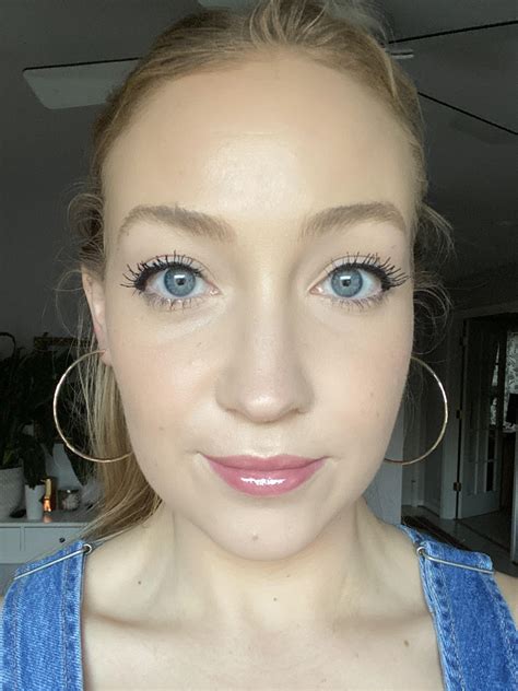 swelling on one side of face no pain 2