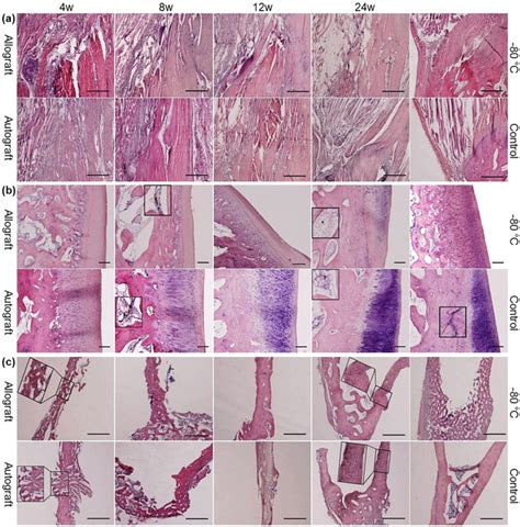 Photomicrographs Of The Junction Of The Quadriceps Tendon And The Soft