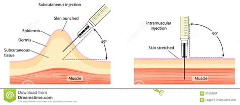 Subcutaneous Injection Site Chart