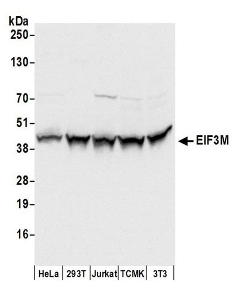 Eif3m Polyclonal Antibody A304 761a T