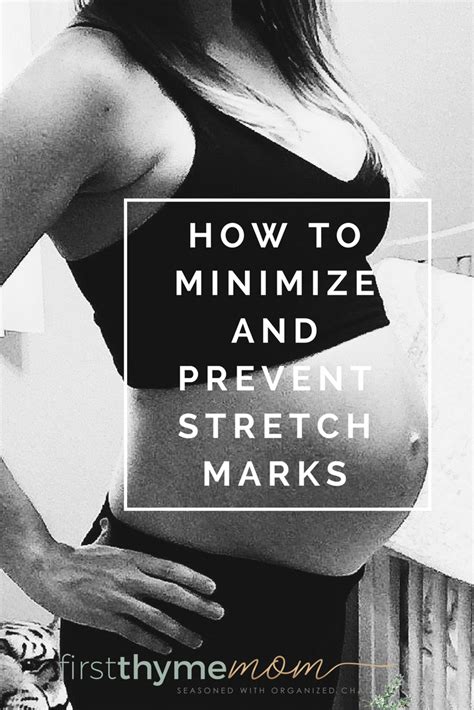 How To Minimize And Possibly Prevent Stretch Marks During Pregnancy