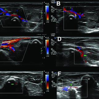 Representative color Doppler ultrasonographic images of the arterial... | Download Scientific ...