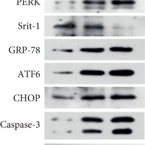 Effects Of Fluoride Exposure On Sirt 1 ERS And Apoptosis Pathways In