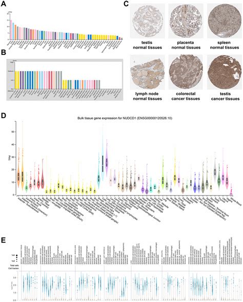 Identifying The Role Of Nudcd In Human Tumors From Clinical And