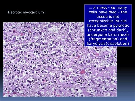 PPT - Necrosis and apoptosis PowerPoint Presentation, free download ...