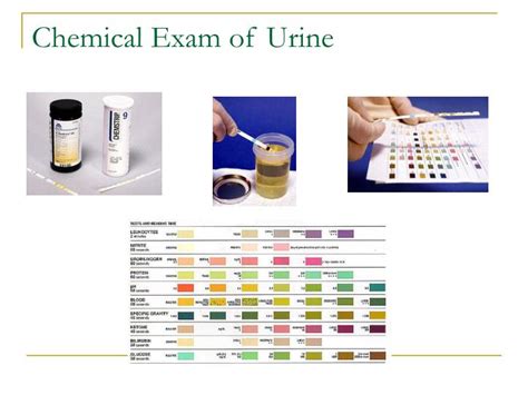 PPT Clinical Urinalysis Review PowerPoint Presentation ID 807647