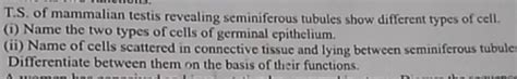 T S Of Mammalian Testis Revealing Seminiferous Tubules Show Different Ty