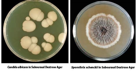 M I Tr Ng Vi Sinh Sabouraud Dextrose Agar Alphachem