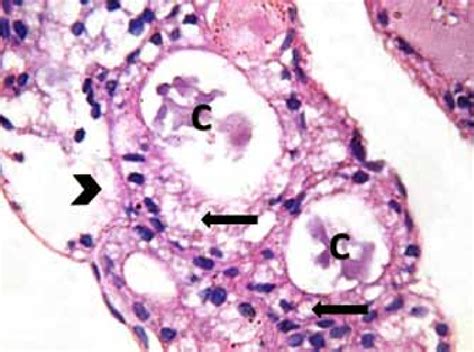 Higher Magnification Of The Previous Section Showing Highly Vacuolated