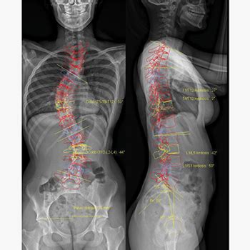 EOS X-Ray System Surgeons Kuala Lumpur | EOS X-Ray System Surgery Kuala ...