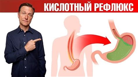 Как избавиться от ГЭРБ раз и навсегда? Кислотный рефлюкс
