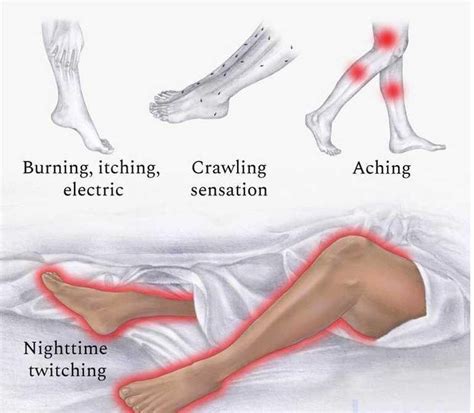 What Is Restless Leg Syndrome Scientists Find Genetic Clues To Treat