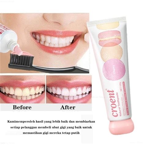 Toothpaste Teeth Whitening Fresh Breath Gigi Putih Teeth White