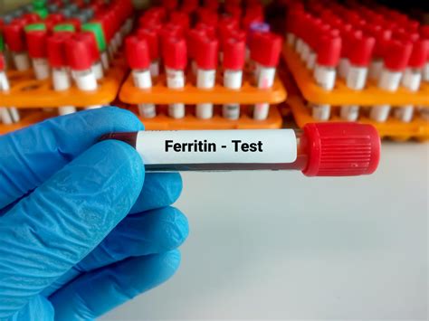 Ferritin Blood Test: What High Level of Ferritin Is Concerning ... 