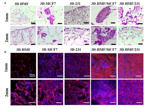 Hematoxylineosin Staining Of Developed 3d Tumor Models Constructs At