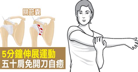 「五十肩」一發作沒完沒了，每天「5分鐘」肩膀運動，關節不老自