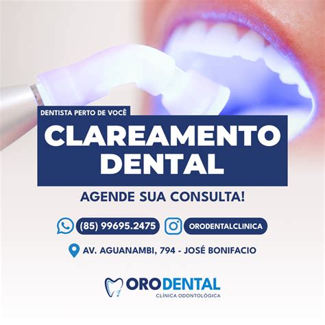 Clareamento Dental Em Fortaleza Dentista Fortaleza Dra Poliana