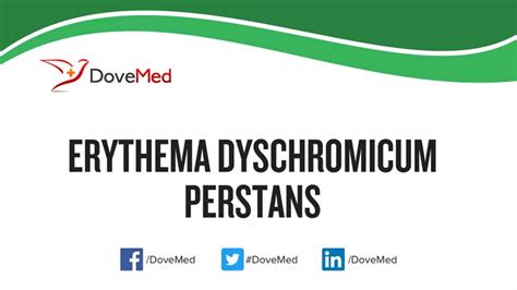 Erythema Dyschromicum Perstans Dovemed