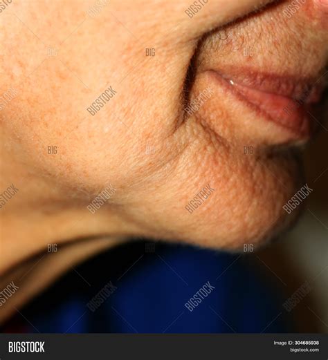 Sunken Cheeks Image And Photo Free Trial Bigstock