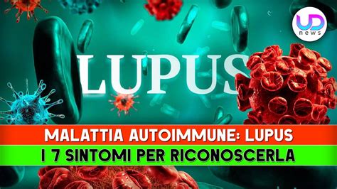 Malattia Autoimmune Lupus I Sintomi Per Riconoscerla Youtube