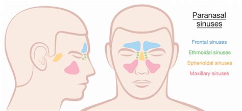 Peri Orbital Cellulitis Pathophysiology Managment Teachmepaediatrics