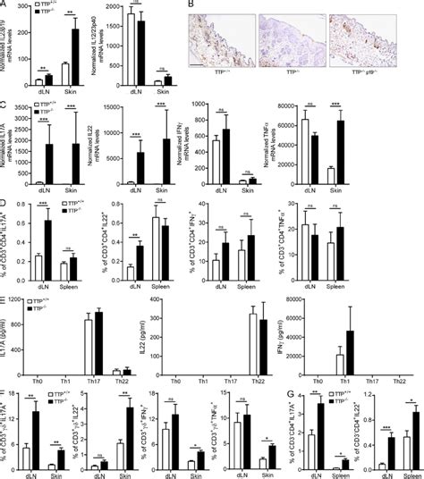 Enhanced Il And Il Responses As Consequence Of The Increased Il