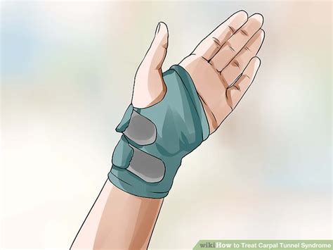 How To Treat Carpal Tunnel Syndrome 11 Steps With Pictures