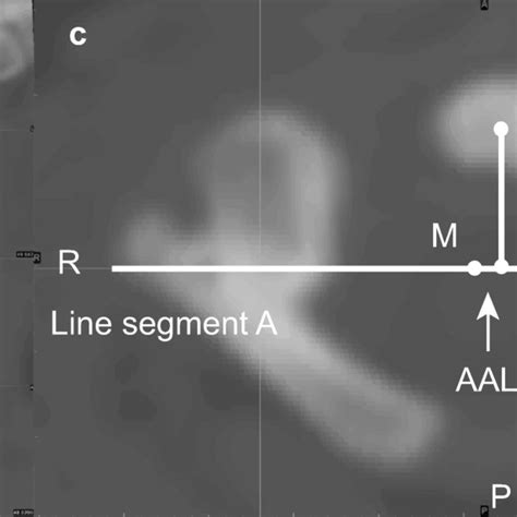 Axis transverse image. a The image in transverse direction was visible... | Download Scientific ...