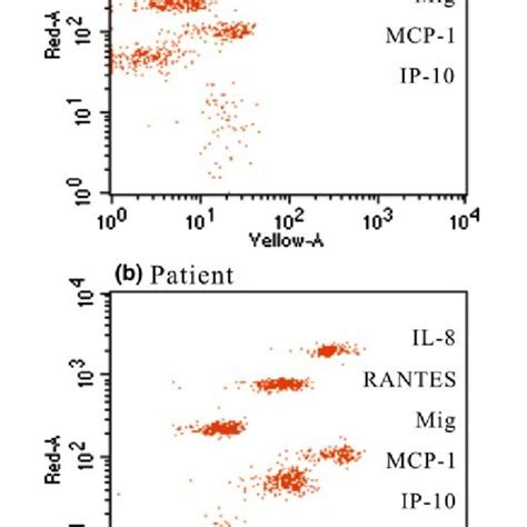 Representative Data For Cytometric Bead Array Chemokine From Controls Download Scientific