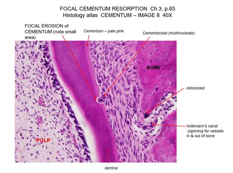 Cementum Histology