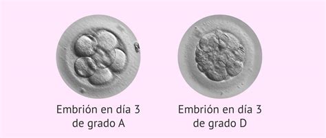 Clasificación de los embriones según su calidad